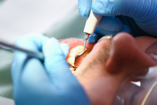 Best Weekend Emergency Dental Services in Redmond, WA