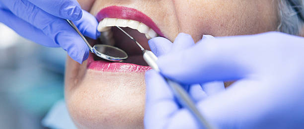 Best Emergency Denture Repair in Redmond, WA